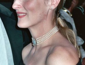 Meryl Streep plastic surgery (10)