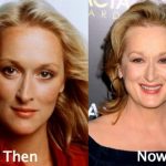 Meryl Streep plastic surgery (20)
