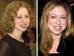 Chelsea Clinton before and after plastic surgery (11)