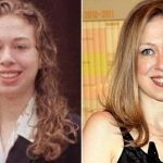 Chelsea Clinton before and after plastic surgery (13)