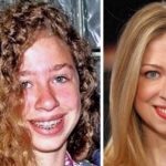 Chelsea Clinton before and after plastic surgery