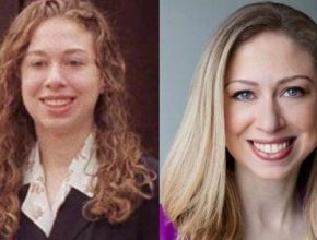 Chelsea Clinton before and after plastic surgery (16)