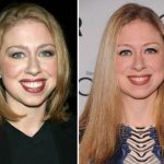 Chelsea Clinton before and after plastic surgery (17)