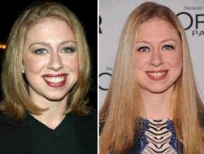 Chelsea Clinton before and after plastic surgery (17)