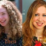 Chelsea Clinton before and after plastic surgery (20)