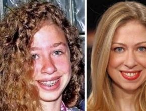 Chelsea Clinton before and after plastic surgery