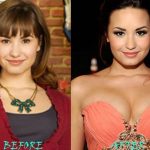 Demi Lovato after breast augmentation (17)