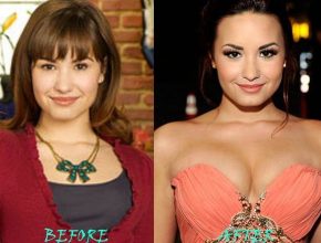 Demi Lovato after breast augmentation (17)