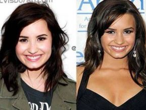 Demi Lovato after breast augmentation (25)