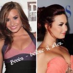 Demi Lovato before and after breast augmentation (29)