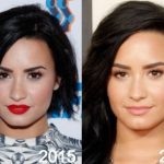 Demi Lovato before and after plastic surgery (10)