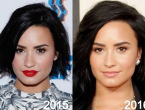 Demi Lovato before and after plastic surgery (10)