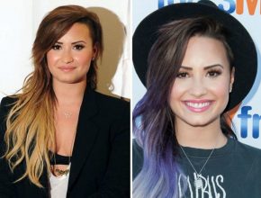 Demi Lovato before and after plastic surgery