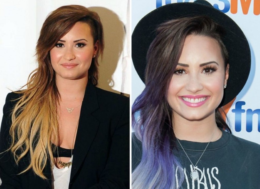 Demi Lovato before and after plastic surgery