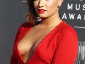 Demi Lovato plastic surgery