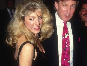 Donald Trump before plastic surgery (8)