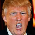 Donald Trump plastic surgery (21)