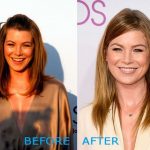Ellen Pompeo before and after plastic surgery (12)