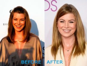 Ellen Pompeo before and after plastic surgery (12)