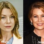 Ellen Pompeo before and after plastic surgery (13)