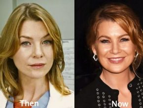 Ellen Pompeo before and after plastic surgery (13)