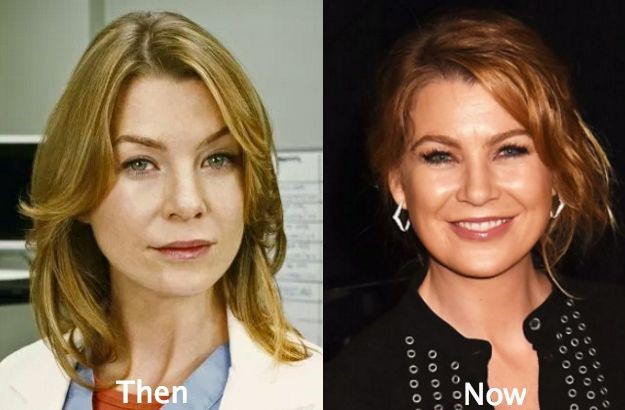 Ellen Pompeo before and after plastic surgery (13)