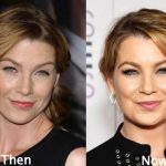 Ellen Pompeo before and after plastic surgery (14)