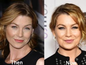 Ellen Pompeo before and after plastic surgery (14)