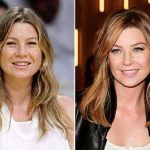 Ellen Pompeo before and after plastic surgery (15)