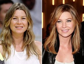 Ellen Pompeo before and after plastic surgery (15)
