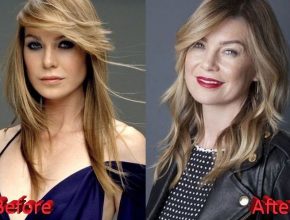 Ellen Pompeo before and after plastic surgery (9)