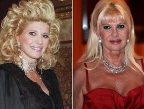 Ivana Trump before and after plastic surgery