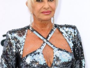 Ivana Trump plastic surgery (12)