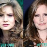 Jennifer Jason Leigh before and after plastic surgery (2)