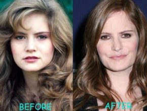 Jennifer Jason Leigh before and after plastic surgery (2)