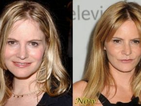 Jennifer Jason Leigh before and after plastic surgery (24)