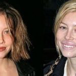 Jessica Biel before and after lip augmentation (34)
