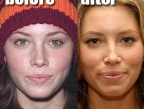 Jessica Biel before and after nose job (6)