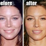 Jessica Biel before and after plastic surgery (11)