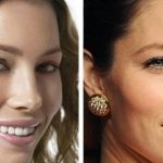 Jessica Biel before and after plastic surgery (18)