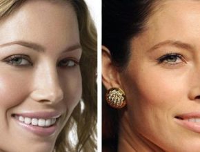 Jessica Biel before and after plastic surgery (18)