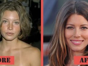 Jessica Biel before and after plastic surgery (33)