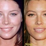 Jessica Biel before and after plastic surgery (6)