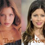 Jessica Biel plastic surgery (31)