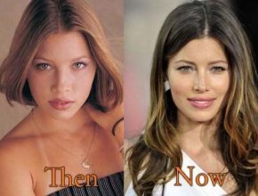 Jessica Biel plastic surgery (31)