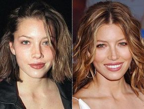 Jessica Biel plastic surgery