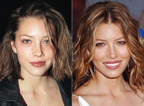 Jessica Biel before and after plastic surgery