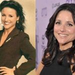 Julia Louis-Dreyfus before and after plastic surgery (15)