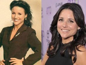 Julia Louis-Dreyfus before and after plastic surgery (15)