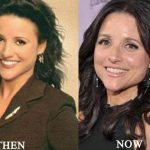 Julia Louis-Dreyfus before and after plastic surgery (17)